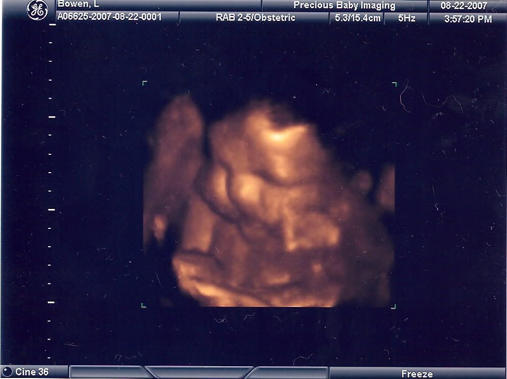 3d ultrasound scan. 3d ultrasound scan.
